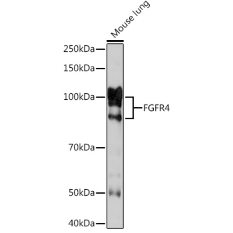 Western Blot - Anti-FGFR4 Antibody [ARC1474] (A308727) - Antibodies.com