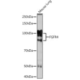 Western Blot - Anti-FGFR4 Antibody [ARC1474] (A308727) - Antibodies.com