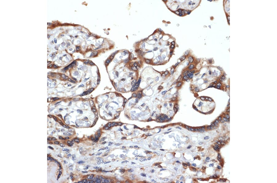 Immunohistochemistry - Anti-FGFR4 Antibody [ARC1474] (A308727) - Antibodies.com