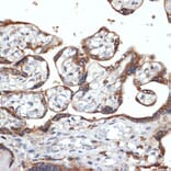 Immunohistochemistry - Anti-FGFR4 Antibody [ARC1474] (A308727) - Antibodies.com