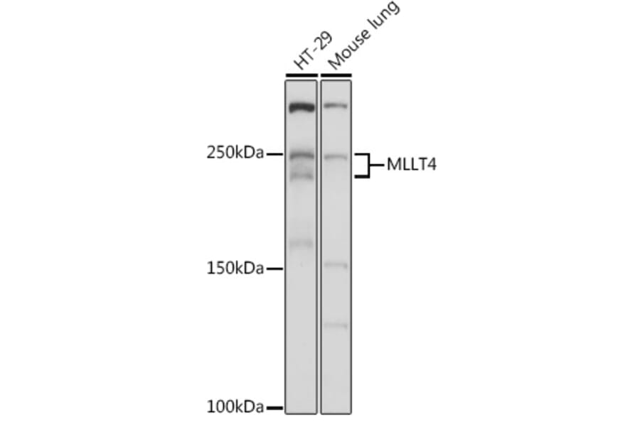 Western Blot - Anti-I Afadin Antibody (A308730) - Antibodies.com
