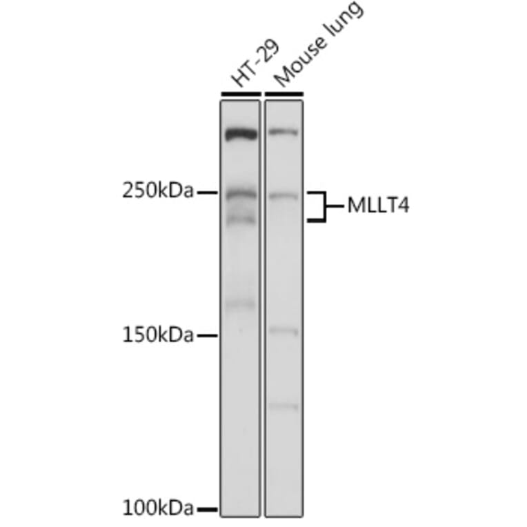 Western Blot - Anti-I Afadin Antibody (A308730) - Antibodies.com