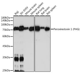 Western Blot - Anti-PAG Antibody [ARC2448] (A308731) - Antibodies.com