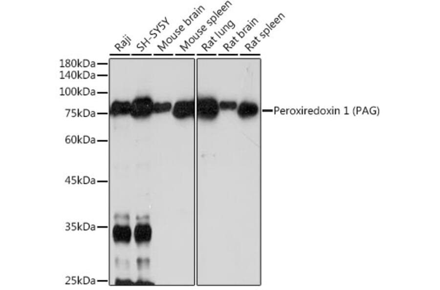 Western Blot - Anti-PAG Antibody [ARC2448] (A308731) - Antibodies.com
