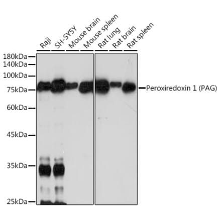 Western Blot - Anti-PAG Antibody [ARC2448] (A308731) - Antibodies.com