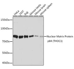 Western Blot - Anti-Nuclear Matrix Protein p84 Antibody [ARC1504] (A308733) - Antibodies.com