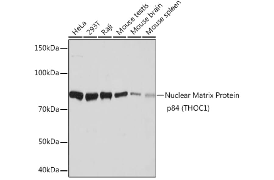 Western Blot - Anti-Nuclear Matrix Protein p84 Antibody [ARC1504] (A308733) - Antibodies.com