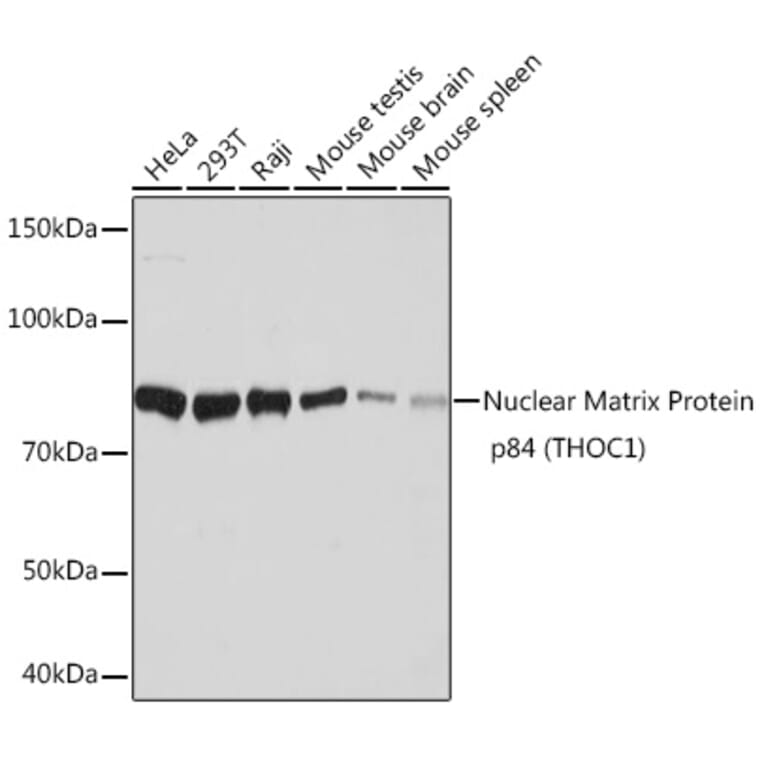 Western Blot - Anti-Nuclear Matrix Protein p84 Antibody [ARC1504] (A308733) - Antibodies.com