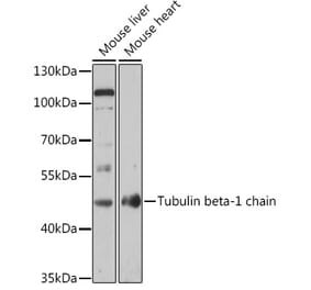 Western Blot - Anti-beta I Tubulin Antibody (A308734) - Antibodies.com