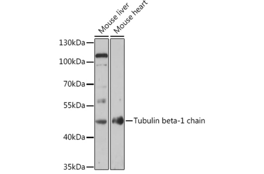 Western Blot - Anti-beta I Tubulin Antibody (A308734) - Antibodies.com