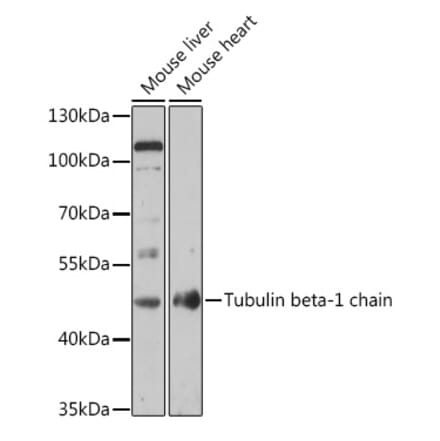 Western Blot - Anti-beta I Tubulin Antibody (A308734) - Antibodies.com