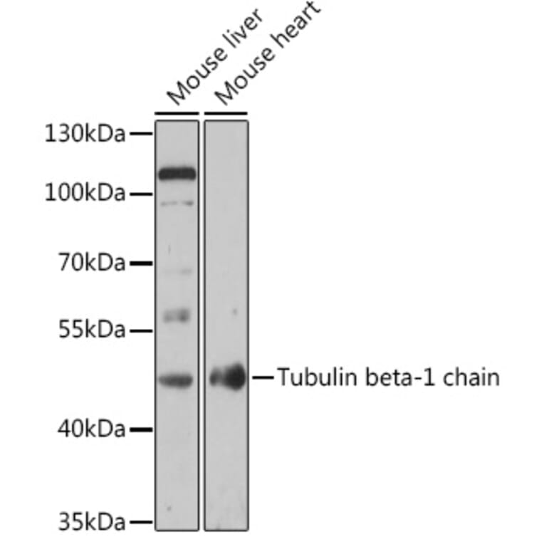 Western Blot - Anti-beta I Tubulin Antibody (A308734) - Antibodies.com