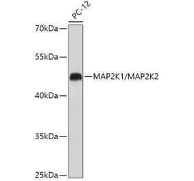 Western Blot - Anti-MEK1 + MEK2 Antibody (A308735) - Antibodies.com