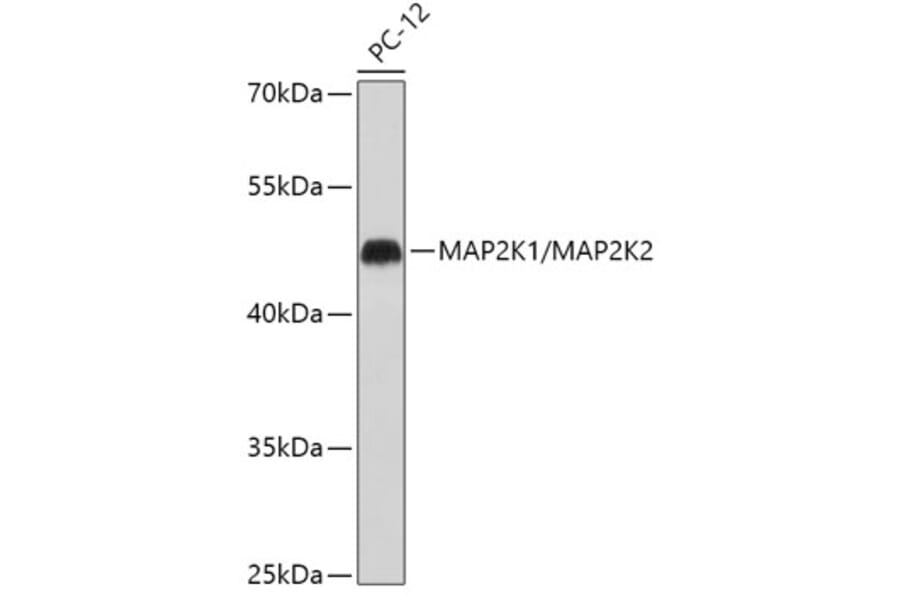 Western Blot - Anti-MEK1 + MEK2 Antibody (A308735) - Antibodies.com