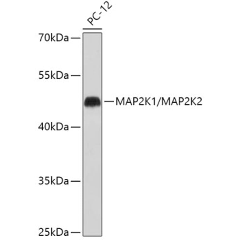 Western Blot - Anti-MEK1 + MEK2 Antibody (A308735) - Antibodies.com