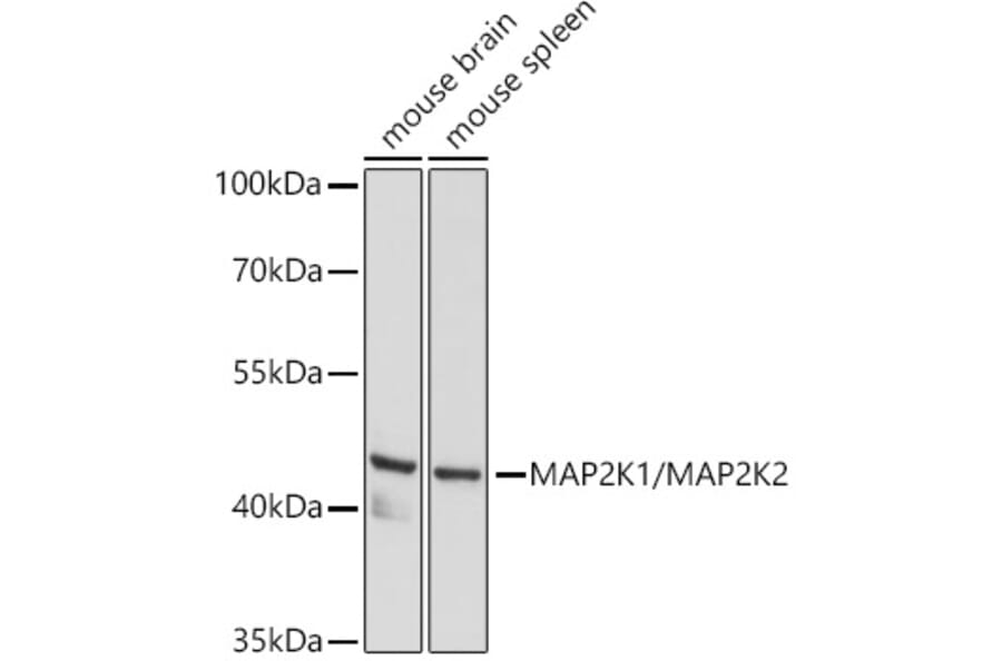 Western Blot - Anti-MEK1 + MEK2 Antibody (A308735) - Antibodies.com