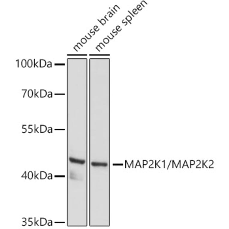 Western Blot - Anti-MEK1 + MEK2 Antibody (A308735) - Antibodies.com