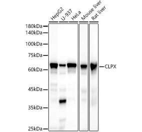 Western Blot - Anti-CLPX Antibody [ARC2812] (A308736) - Antibodies.com