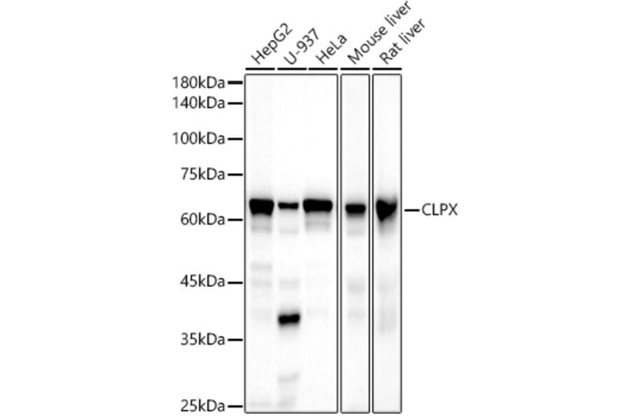 Western Blot - Anti-CLPX Antibody [ARC2812] (A308736) - Antibodies.com