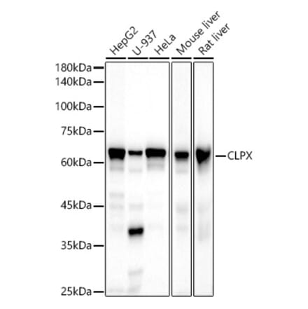 Western Blot - Anti-CLPX Antibody [ARC2812] (A308736) - Antibodies.com