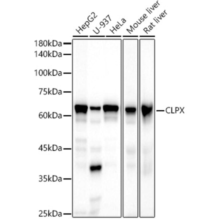Western Blot - Anti-CLPX Antibody [ARC2812] (A308736) - Antibodies.com