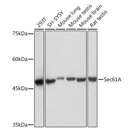 Western Blot - Anti-SEC61A2 Antibody [ARC2323] (A308737) - Antibodies.com