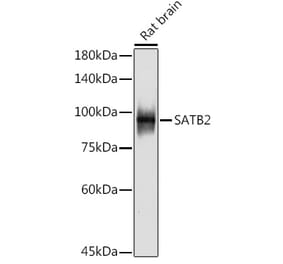 Western Blot - Anti-SATB2 Antibody [ARC2363] (A308738) - Antibodies.com