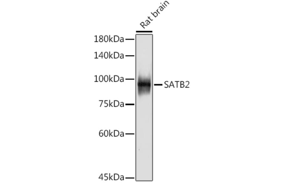 Western Blot - Anti-SATB2 Antibody [ARC2363] (A308738) - Antibodies.com