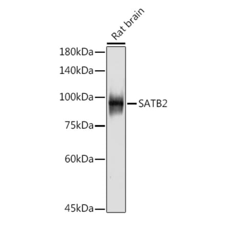 Western Blot - Anti-SATB2 Antibody [ARC2363] (A308738) - Antibodies.com