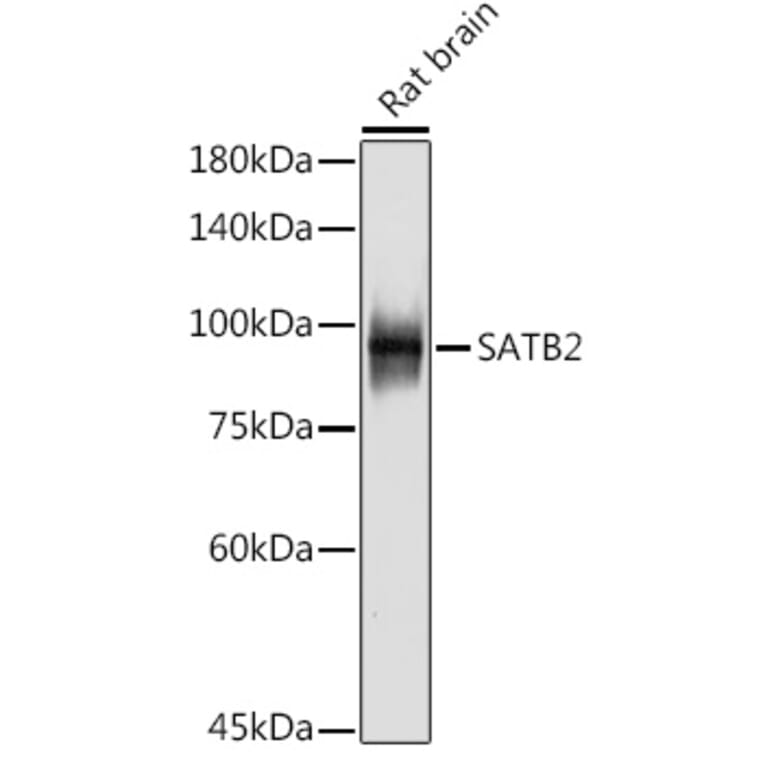 Western Blot - Anti-SATB2 Antibody [ARC2363] (A308738) - Antibodies.com