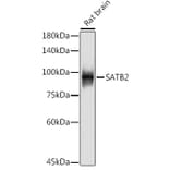 Western Blot - Anti-SATB2 Antibody [ARC2363] (A308738) - Antibodies.com
