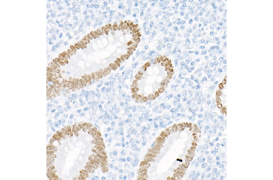 Immunohistochemistry - Anti-SATB2 Antibody [ARC2363] (A308738) - Antibodies.com