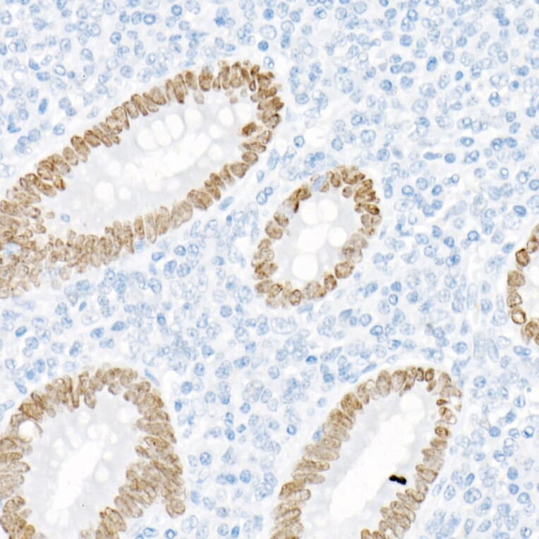 Immunohistochemistry - Anti-SATB2 Antibody [ARC2363] (A308738) - Antibodies.com