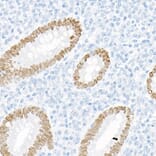 Immunohistochemistry - Anti-SATB2 Antibody [ARC2363] (A308738) - Antibodies.com