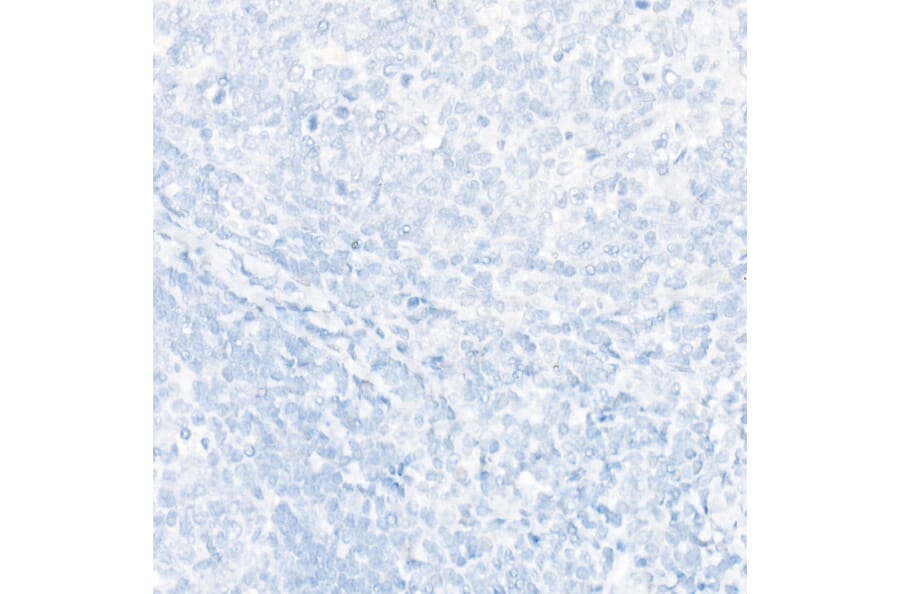 Immunohistochemistry - Anti-SATB2 Antibody [ARC2363] (A308738) - Antibodies.com