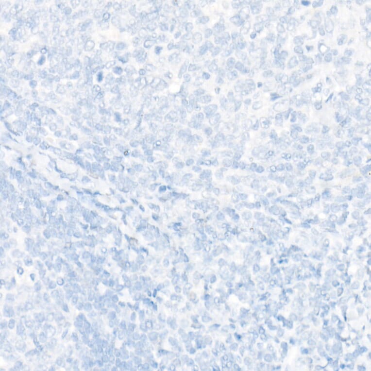 Immunohistochemistry - Anti-SATB2 Antibody [ARC2363] (A308738) - Antibodies.com