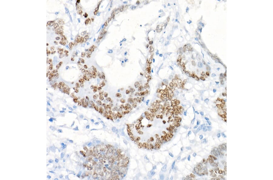 Immunohistochemistry - Anti-SATB2 Antibody [ARC2363] (A308738) - Antibodies.com