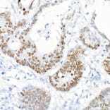 Immunohistochemistry - Anti-SATB2 Antibody [ARC2363] (A308738) - Antibodies.com