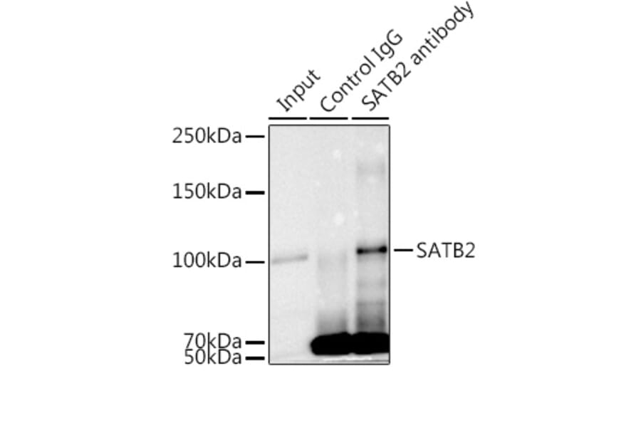 Western Blot - Anti-SATB2 Antibody [ARC2363] (A308738) - Antibodies.com