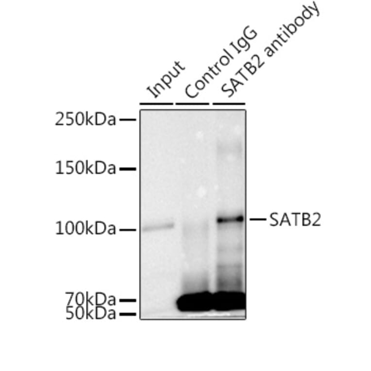 Western Blot - Anti-SATB2 Antibody [ARC2363] (A308738) - Antibodies.com