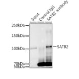 Western Blot - Anti-SATB2 Antibody [ARC2363] (A308738) - Antibodies.com