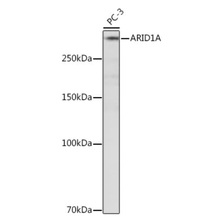 Western Blot - Anti-ARID1A Antibody [ARC2177] (A308739) - Antibodies.com