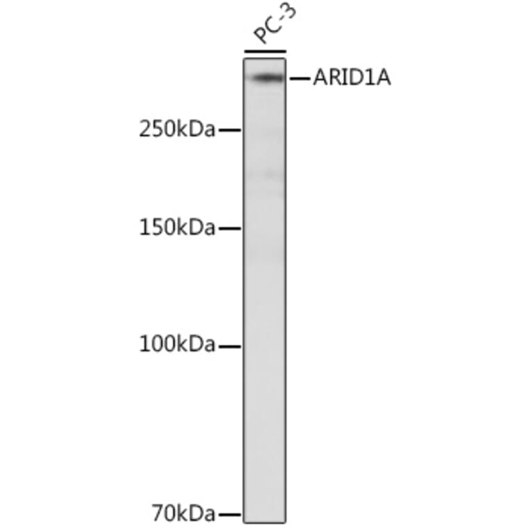 Western Blot - Anti-ARID1A Antibody [ARC2177] (A308739) - Antibodies.com