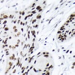 Immunohistochemistry - Anti-ARID1A Antibody [ARC2177] (A308739) - Antibodies.com