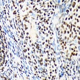 Immunohistochemistry - Anti-ARID1A Antibody [ARC2177] (A308739) - Antibodies.com
