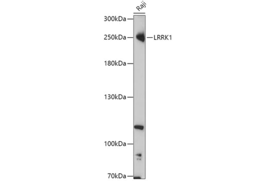 Western Blot - Anti-LRRK1 Antibody (A308740) - Antibodies.com