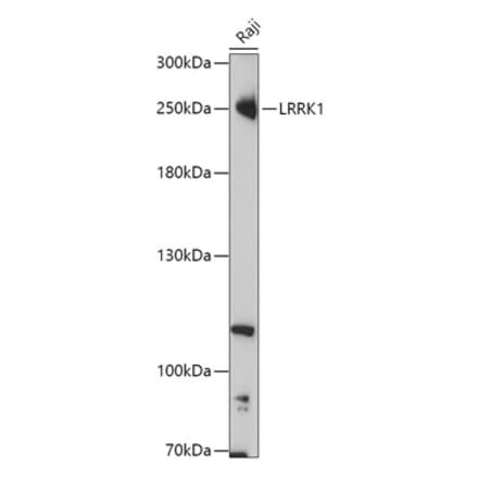 Western Blot - Anti-LRRK1 Antibody (A308740) - Antibodies.com