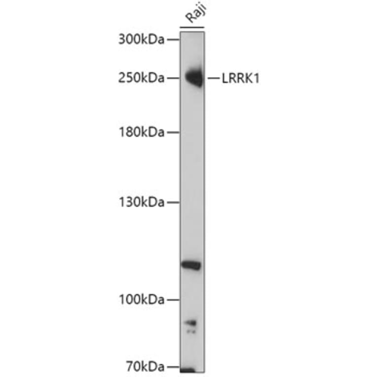 Western Blot - Anti-LRRK1 Antibody (A308740) - Antibodies.com