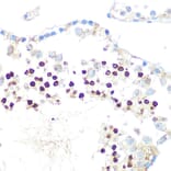 Immunohistochemistry - Anti-HP1 alpha Antibody [ARC0244] (A308742) - Antibodies.com