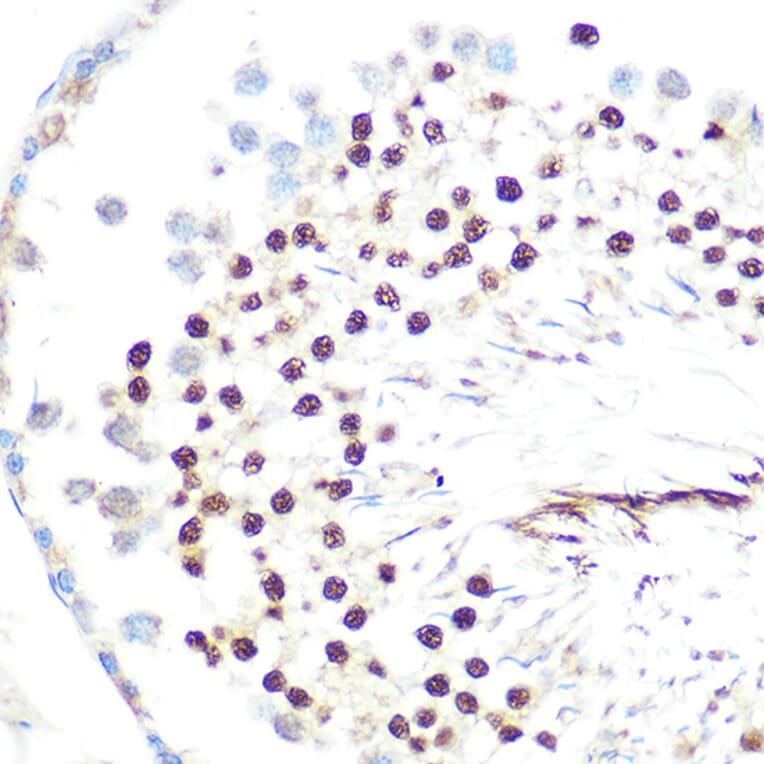 Immunohistochemistry - Anti-HP1 alpha Antibody [ARC0244] (A308742) - Antibodies.com